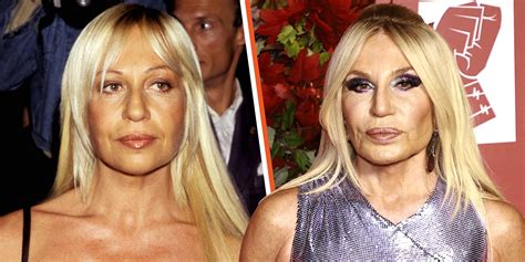 donatella versace plastic|donatella versace meaning.